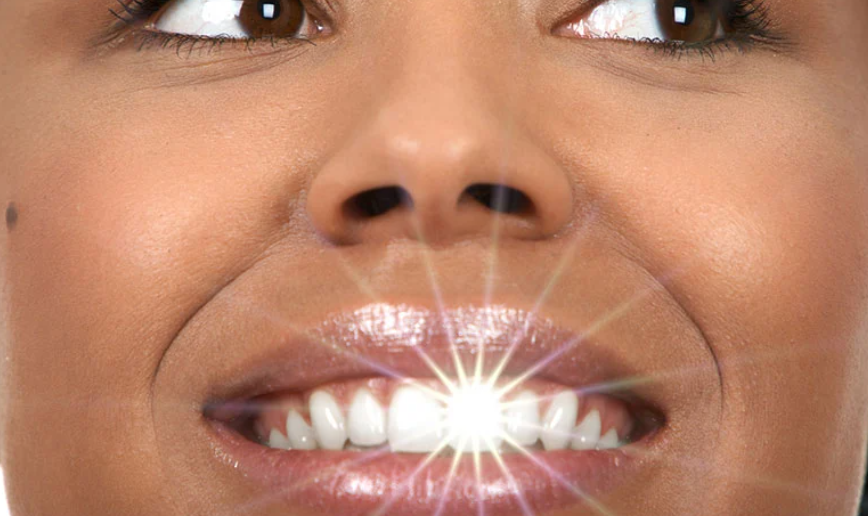 whitening teeth