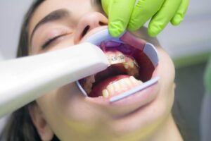 teeth